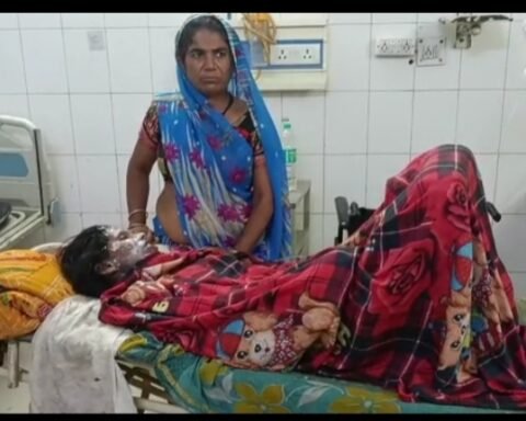 पत्नी को लगाई आग